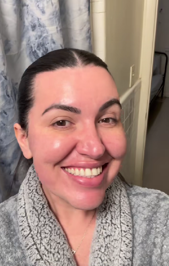 Işıldayan bir gülüşün sırrı - El secreto de una sonrisa radiante