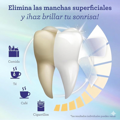 PerlaBlanca® Eloura Teeth Whitening Strips - PerlaBlanca® Eloura Tiras blanqueadoras de dientes